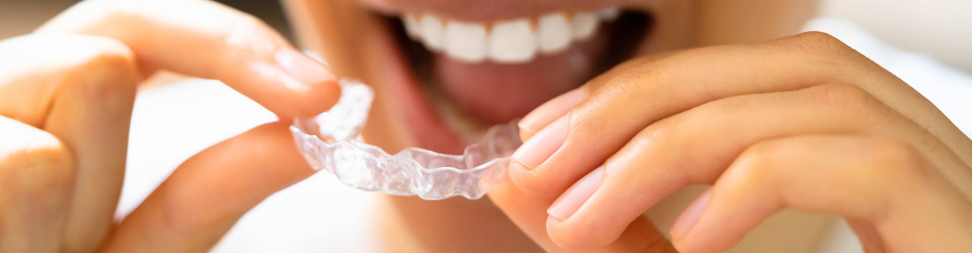 Woman placing clear aligner onto upper teeth.